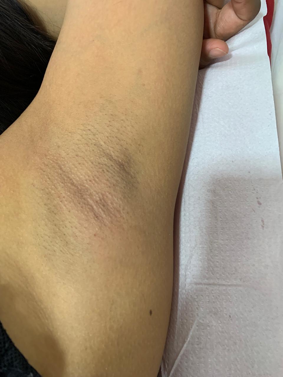 Axila feminina com pele lisa depois da depilação com cera natural
